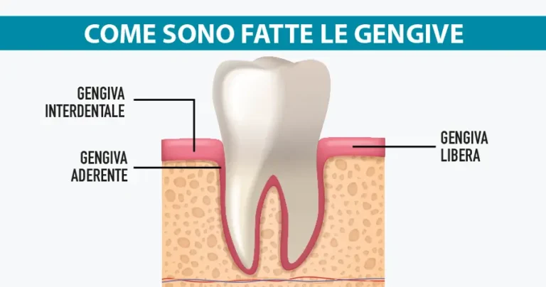 come sono fatte le gengive michelangelo13