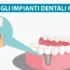 Perché cadono gli impianti dentali