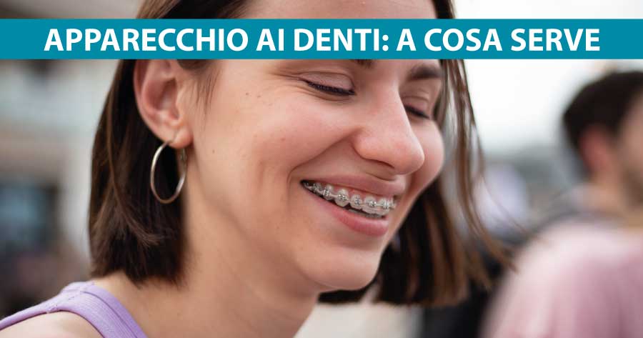 Apparecchio ai denti a cosa serve - Studio Dentistico Michelangelo 13 Vomero (Napoli)